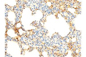 ABIN6267069 at 1/100 staining rat lung tissue sections by IHC-P.