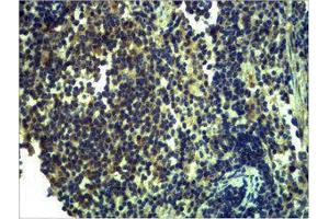 Immunohistochemistry (IHC) image for anti-Toll-Like Receptor 13 (Tlr13) antibody (ABIN3179055) (TLR13 anticorps)