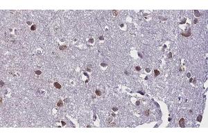 ABIN6268871 at 1/100 staining Human brain cancer tissue by IHC-P. (beta Synuclein anticorps  (C-Term))