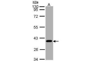 WB Image Sample (30 ug of whole cell lysate) A: A431 10% SDS PAGE antibody diluted at 1:1000 (SUCLG1 anticorps)