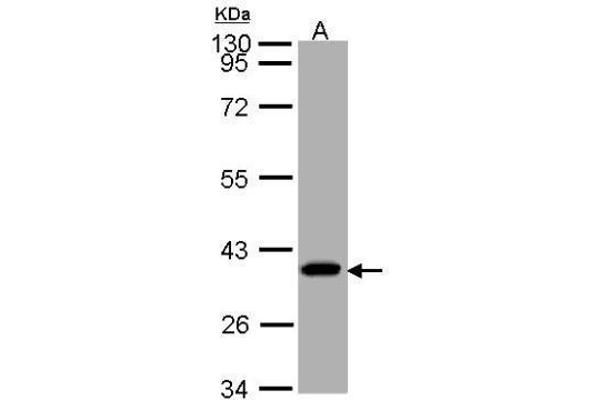 SUCLG1 anticorps
