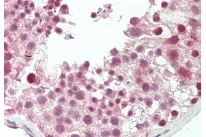 Rabbit Anti-RARG antibody  Formalin Fixed Paraffin Embedded Tissue: Human Testis Primary antibody Concentration: 1:66.