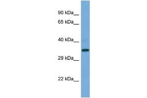 Western Blotting (WB) image for anti-Presenilin 2 (Alzheimer Disease 4) (PSEN2) (C-Term) antibody (ABIN2787885) (Presenilin 2 anticorps  (C-Term))