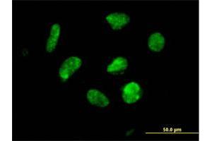 Immunofluorescence of purified MaxPab antibody to ZNF302 on HeLa cell. (ZNF302 anticorps  (AA 1-399))