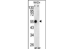 Western blot analysis of ATP5B Antibody (Center) Pab (ABIN650786 and ABIN2839558) pre-incubated without(lane 1) and with(lane 2) blocking peptide in WiDr cell line lysate. (ATP5B anticorps  (AA 135-163))