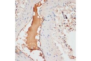 Immunohistochemistry of paraffin-embedded human lung using  antibody (ABIN6127360, ABIN6137012, ABIN6137013 and ABIN6221266) at dilution of 1:100 (40x lens). (APOC1 anticorps  (AA 1-83))