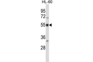 Western Blotting (WB) image for anti-BAI1-Associated Protein 2-Like 2 (BAIAP2L2) antibody (ABIN2997368)