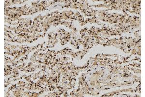 ABIN6272437 at 1/100 staining Human lung tissue by IHC-P. (ZNF280A anticorps  (C-Term))