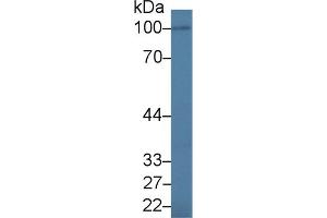 Western Blot; Sample: Human BXPC3 cell lysate; Primary Ab: 1. (IL17RA anticorps  (AA 377-534))