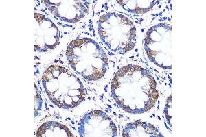 Immunohistochemistry of paraffin-embedded human colon using WISP2 Rabbit pAb (ABIN6128929, ABIN6150227, ABIN6150229 and ABIN6223338) at dilution of 1:100 (40x lens). (WISP2 anticorps  (AA 1-250))