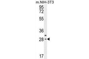 Western Blotting (WB) image for anti-Claudin 22 (CLDN22) antibody (ABIN2995576) (Claudin 22 (CLDN22) anticorps)
