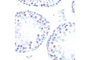 Immunohistochemistry of paraffin-embedded mouse testis using Cyclin H Rabbit mAb (ABIN7266569) at dilution of 1:100 (40x lens).