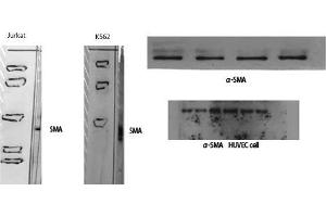 Western Blot (WB) analysis of specific cells using alpha-SMA Polyclonal Antibody. (alpha-SMA (N-Term) anticorps)