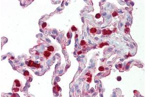 Anti-KAL1 / Anosmin antibody IHC staining of human lung. (Anosmin anticorps  (Internal Region))