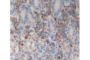 Used in DAB staining on fromalin fixed paraffin- embedded Kidney tissue (MGA anticorps  (AA 2450-2733))