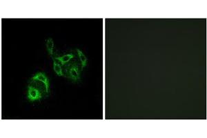 Immunofluorescence analysis of A549 cells, using SLC27A4 antibody.
