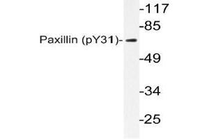 Western blot (WB) analyzes of p-Paxillin (pTyr31) antibody in extracts from HeLa TNF cells. (Paxillin anticorps  (pTyr31))