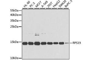 Western blot analysis of extracts of various cell lines, using RPS19 antibody. (RPS19 anticorps  (AA 1-145))