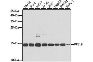 Western blot analysis of extracts of various cell lines, using RPS19 antibody.