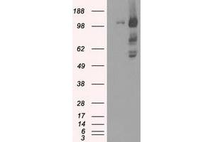 HEK293T cells were transfected with the pCMV6-ENTRY control (Left lane) or pCMV6-ENTRY BUB1B (Right lane) cDNA for 48 hrs and lysed. (BUB1B anticorps)