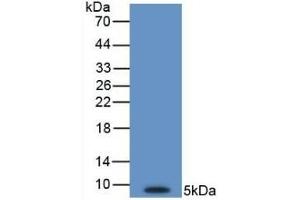 Detection of Recombinant EDN1, Human using Monoclonal Antibody to Endothelin 1 (EDN1)