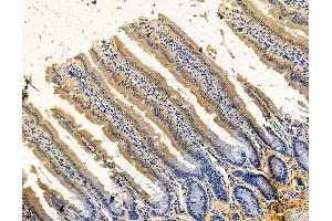 ABIN7096111 and ABIN7100173 at 1/100 staining rat colorectal tissue by IHC-P. (Leiomodin 2 anticorps)