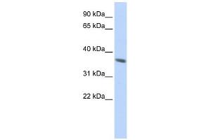 Cytokeratin 222 Pseudogene antibody used at 1 ug/ml to detect target protein. (KRT222 anticorps  (N-Term))