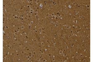 ABIN6254871 and ABIN6274016 at 1/100 staining Rat brain tissue by IHC-P. (Histone H2A anticorps  (H2AK9ac))