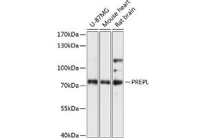 Western blot analysis of extracts of various cell lines, using PREPL antibody (ABIN7269561) at 1:3000 dilution. (PREPL anticorps  (AA 578-727))