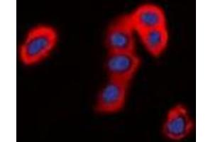 Immunofluorescent analysis of TMEM16J staining in HepG2 cells. (ANO9 anticorps)
