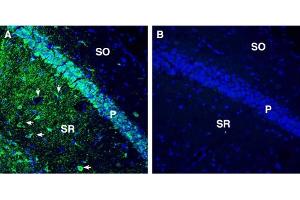Expression of Tetraspanin 7 in the mouse hippocampus. (Tetraspanin 7 anticorps  (Extracellular))