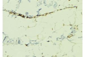 ABIN6268970 at 1/100 staining Human lung tissue by IHC-P.