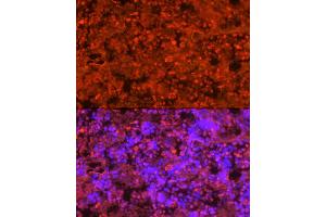 Immunofluorescence analysis of rat bone marrow cells using Neutrophil Elastase (ELANE) Rabbit pAb (ABIN6131604, ABIN6140110, ABIN6140111 and ABIN6216843) at dilution of 1:250 (40x lens).
