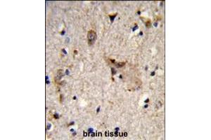 Formalin-fixed and paraffin-embedded human brain tissue reacted with ALDH18A1 Antibody , which was peroxidase-conjugated to the secondary antibody, followed by DAB staining.