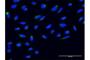 Immunofluorescence of monoclonal antibody to NUCB2 on HeLa cell.