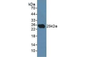Detection of CD301 in Rat Testis Tissue using Polyclonal Antibody to Cluster Of differentiation 301 (CD301) (CLEC10A anticorps  (AA 71-239))