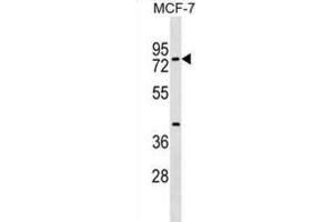 Western Blotting (WB) image for anti-TOX High Mobility Group Box Family Member 4 (TOX4) antibody (ABIN2999628) (TOX4 anticorps)