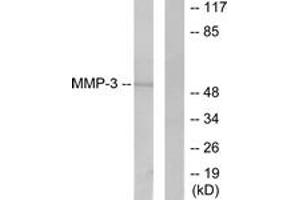 Western blot analysis of extracts from 293 cells, using MMP-3 Antibody. (MMP3 anticorps  (AA 421-470))