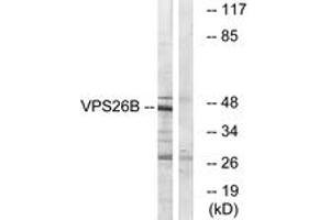 Western blot analysis of extracts from LOVO cells, using VPS26B Antibody. (VPS26B anticorps  (AA 231-280))