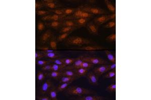 Immunofluorescence analysis of H9C2 cells using PRMT5 Rabbit pAb (ABIN3022065, ABIN3022066, ABIN3022067 and ABIN6218592) at dilution of 100 (40x lens).