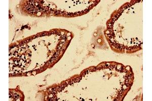 Immunohistochemistry analysis of human small intestine tissue using ABIN7158439 at dilution of 1:100
