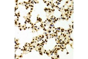 Immunohistochemistry of paraffin-embedded Mouse lung using DiMethyl-Histone H3-K27 antibody.