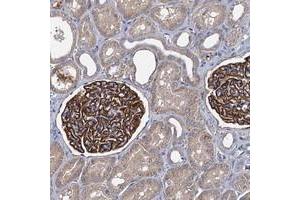 Immunohistochemical staining of human kidney with LRRC18 polyclonal antibody  shows distinct positivity in cells in glomeruli.