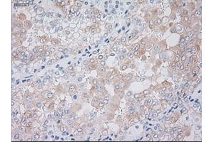 Immunohistochemistry (IHC) image for anti-Keratin 19 (KRT19) (AA 240-390) antibody (ABIN1491259) (Cytokeratin 19 anticorps  (AA 240-390))