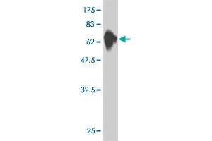 Western Blot detection against Immunogen (76. (MKNK1 anticorps  (AA 1-465))