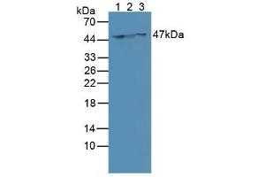 Western blot analysis of (1) Human MCF-7 Cells, (2) Human SGC7901 Cells and (3) Human HeLa cells. (Cytokeratin 18 anticorps  (AA 72-380))