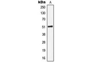 Western blot analysis of Cytokeratin 16 expression in HeLa (A) whole cell lysates.