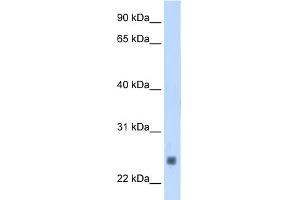 WB Suggested Anti-TNNI2 Antibody Titration:  1. (TNNI2 anticorps  (N-Term))