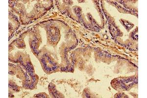 Immunohistochemistry of paraffin-embedded human prostate tissue using ABIN7173847 at dilution of 1:100