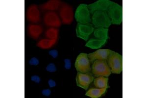 ABIN6257755 and ABIN6273649 staining Hela cells(30 min of UV treatment) by IF/ICC. (IL12B anticorps  (C-Term))